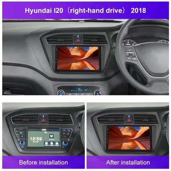 Car Frame Fascia Adapter For Hyundai I20 I-20 2018+ Android Radio Dash Fitting Panel Kit (XD-054) - Image 2